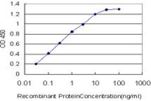 Detection limit for recombinant GST tagged CACNB2 is approximately 0. (CACNB2 Antikörper  (AA 213-301))