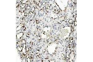 IHC analysis of NOVA2 using anti-NOVA2 antibody (ABIN7599078).