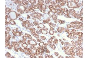 Immunohistochemistry (IHC) image for anti-Keratin 18 (KRT18) antibody (ABIN6939938)