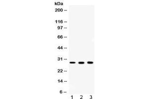 Western blot testing of 1) rat ovary, 2) mouse liver and 3) human MCF7 lysate with CA2 antibody at 0. (CA2 Antikörper)
