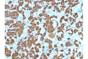 Formalin-fixed, paraffin-embedded human Pituitary stained with Growth Hormone Monoclonal Antibody (SPM106). (Growth Hormone 1 Antikörper  (AA 58-187))