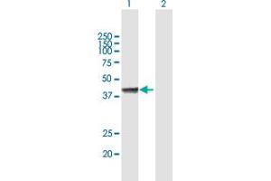Western Blot analysis of FOSL2 expression in transfected 293T cell line by FOSL2 MaxPab polyclonal antibody. (FOSL2 Antikörper  (AA 1-326))