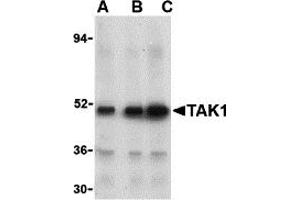 Western Blotting (WB) image for anti-Nuclear Receptor Subfamily 2, Group C, Member 2 (NR2C2) (N-Term) antibody (ABIN1031601) (TR4 Antikörper  (N-Term))