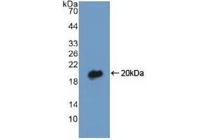 Detection of Recombinant DBI, Human using Polyclonal Antibody to Diazepam Binding Inhibitor (DBI) (Diazepam Binding Inhibitor Antikörper  (AA 1-104))