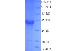 SDS-PAGE (SDS) image for Antigen 85-A (AA 53-331), (partial) protein (His tag) (ABIN5713150) (Antigen 85-A (AA 53-331), (partial) protein (His tag))
