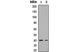 Western blot analysis of FX expression in HeLa (A), rat muscle (B) whole cell lysates. (FX (C-Term) Antikörper)