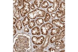 Immunohistochemical staining of human kidney with C9orf82 polyclonal antibody  shows distinct cytoplasmic positivity in cells in tubules.