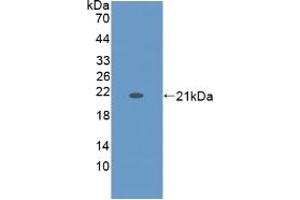 Detection of Recombinant KRT9, Human using Monoclonal Antibody to Cytokeratin 9 (CK9) (KRT9 Antikörper  (AA 315-456))