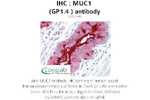 Image no. 1 for anti-Mucin 1 (MUC1) antibody (ABIN1724386) (MUC1 Antikörper)