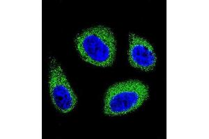 Immunofluorescence (IF) image for anti-7-Dehydrocholesterol Reductase (DHCR7) antibody (ABIN2996203) (DHCR7 Antikörper)
