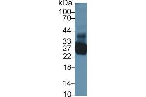 Detection of TNNI1 in Porcine Skeletal muscle lysate using Polyclonal Antibody to Troponin I Type 1, Slow Skeletal (TNNI1) (TNNI1 Antikörper  (AA 1-187))