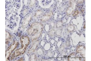 Immunoperoxidase of monoclonal antibody to AMBP on formalin-fixed paraffin-embedded human kidney. (AMBP Antikörper)