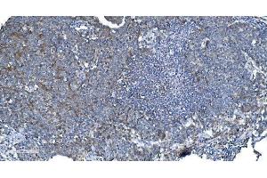 IHC analysis of DRP1/DNM1L using anti-DRP1/DNM1L antibody (ABIN7602180). (Dynamin 1-Like Antikörper  (AA 618-736))