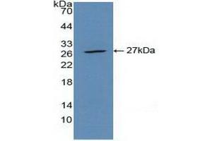 Detection of Recombinant CLEC10A, Mouse using Polyclonal Antibody to Cluster Of differentiation 301 (CD301) (CLEC10A Antikörper  (AA 69-273))