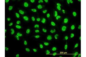 Image no. 2 for anti-serine/threonine Kinase 38 (STK38) (AA 1-466) antibody (ABIN599179) (STK38 Antikörper  (AA 1-466))
