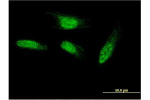 Immunofluorescence of monoclonal antibody to SEC14L2 on HeLa cell.