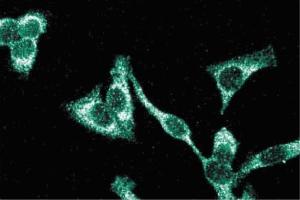 Immunofluorescence staining of HeLa cells (Human cervical epitheloid carcinoma, ATCC CCL-2. (ITGB1 Antikörper  (AA 76-256))