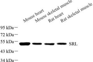 Western blot analysis of Srl (ABIN7075508) at dilution of 1: 500
