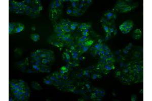 Immunofluorescent staining of HepG2 cells using anti-ALDH2 mouse monoclonal antibody (ABIN2452752). (ALDH2 Antikörper)