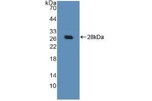 Detection of Recombinant DDB2, Human using Polyclonal Antibody to Damage Specific DNA Binding Protein 2 (DDB2) (DDB2 Antikörper  (AA 166-383))