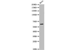 Western Blot analysis of Hela cells using Acetyl-NFκB-p65 (K310) Polyclonal Antibody