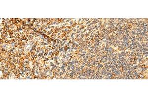 Immunohistochemistry of paraffin-embedded Human tonsil tissue using PPM1B Polyclonal Antibody at dilution of 1:50(x200)