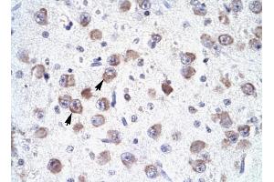 RALY antibody was used for immunohistochemistry at a concentration of 4-8 ug/ml to stain Neural cells (arrows) in Human Brain. (Raly Antikörper  (N-Term))