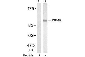Image no. 2 for anti-Insulin-Like Growth Factor 1 Receptor (IGF1R) (Tyr1346) antibody (ABIN319346) (IGF1R Antikörper  (Tyr1346))