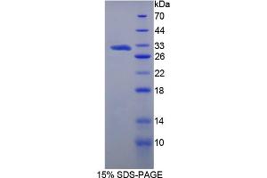 Image no. 1 for Methyltransferase Like 21C (METTL21C) (AA 1-248) protein (His tag) (ABIN6238315)