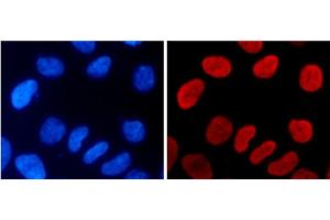 Immunofluorescence analysis of 293T cells using MonoMethyl-Histone H3-K9 Polyclonal Antibody (Histone 3 Antikörper  (meLys9))