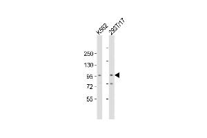 All lanes : Anti-Rai17 Antibody  at 1:2000 dilution Lane 1: K562 whole cell lysates Lane 2: 293T/17 whole cell lysates Lysates/proteins at 20 μg per lane. (ZMIZ1 Antikörper  (C-Term))