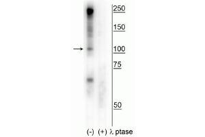 Western blot of human T47D cell lysate showing specific immunolabeling of the ~100 kDa CtIP phosphorylated at Ser327 in the first lane (-). (Retinoblastoma Binding Protein 8 Antikörper  (pSer327))