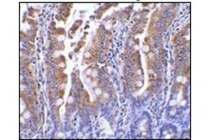 AP20060PU-N PIST antibody staining of Rat Colon tissue by Immunohistochemistry at 1 μg/ml.