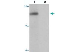 Western blot analysis of SDHAF2 in rat liver tissue with SDHAF2 polyclonal antibody  at 1 ug/mL in (lane 1) the absence and (lane 2) the presence of blocking peptide. (Sdhaf2 Antikörper  (N-Term))