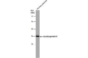 WB Image Human tissue extract (30 μg) was separated by 10% SDS-PAGE, and the membrane was blotted with Apolipoprotein E antibody , diluted at 1:1000. (APOE Antikörper  (N-Term))