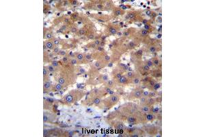 UBE2NL Antibody (N-term) immunohistochemistry analysis in formalin fixed and paraffin embedded human liver tissue followed by peroxidase conjugation of the secondary antibody and DAB staining. (UBE2NL Antikörper  (N-Term))