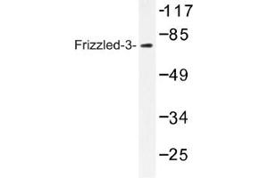 Image no. 1 for anti-Frizzled Family Receptor 3 (FZD3) antibody (ABIN317640) (FZD3 Antikörper)