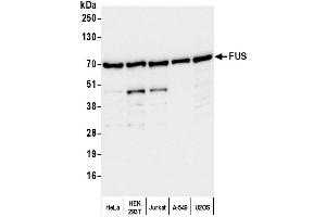 Western Blotting (WB) image for anti-Fused in Sarcoma (FUS) (AA 400-450) antibody (ABIN7453433) (FUS Antikörper  (AA 400-450))