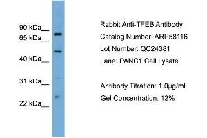 WB Suggested Anti-TFEB  Antibody Titration: 0. (TFEB Antikörper  (Middle Region))