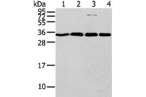 Western Blotting (WB) image for anti-Chromobox Homolog 7 (CBX7) antibody (ABIN5960243) (CBX7 Antikörper)