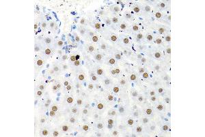 Immunohistochemistry of paraffin-embedded rat liver using PTBP1 antibody at dilution of 1:100 (40x lens). (PTBP1 Antikörper)