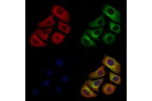 ABIN6261523 and ABIN6277133 staining Hela cells by IF/ICC.