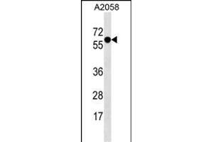 SYT4 Antibody (N-term) (ABIN1539478 and ABIN2838349) western blot analysis in  cell line lysates (35 μg/lane).