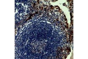 Immunohistochemical analysis of CD62P staining in human tonsil formalin fixed paraffin embedded tissue section. (P-Selectin Antikörper  (N-Term))