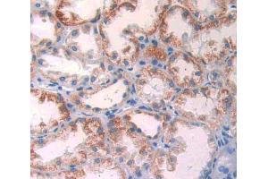 Used in DAB staining on fromalin fixed paraffin- embedded kidney tissue