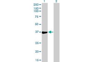 Western Blot analysis of PHF11 expression in transfected 293T cell line by PHF11 MaxPab polyclonal antibody. (PHF11 Antikörper  (AA 1-292))