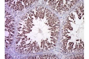 Paraformaldehyde-fixed, paraffin embedded Rat Testis Antigen retrieval by boiling in sodium citrate buffer (pH6. (Calcitonin Receptor Antikörper  (AA 31-120))