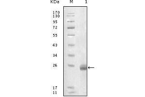Western blot analysis using FBLN5 mouse mAb against truncated FBLN5-His recombinant protein. (Fibulin 5 Antikörper  (AA 242-448))