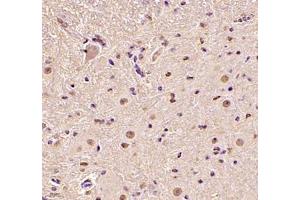 Immunohistochemistry (Paraffin-embedded Sections) (IHC (p)) image for anti-DEAD (Asp-Glu-Ala-As) Box Polypeptide 19B (DDX19B) antibody (ABIN7073694)
