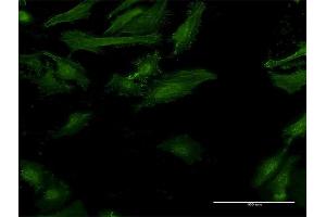 Immunofluorescence of monoclonal antibody to IFNGR2 on HeLa cell. (IFNGR2 Antikörper  (AA 28-127))